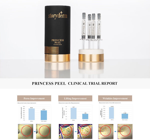 Storyderm Launches the Renewed Gold Micro Needle Therapy “Princess Peel”