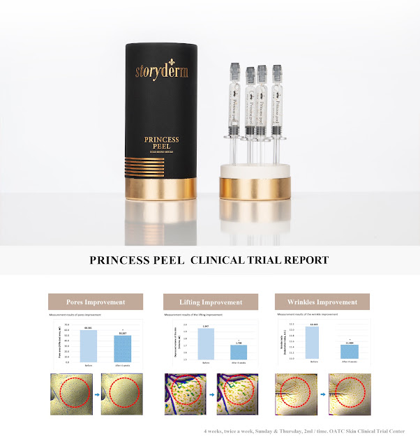 Storyderm Launches the Renewed Gold Micro Needle Therapy "Princess Peel"
